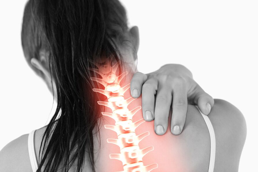 Naiste rindkere lülisamba osteokondroosist tingitud valu võib kiirguda kaela piirkonda